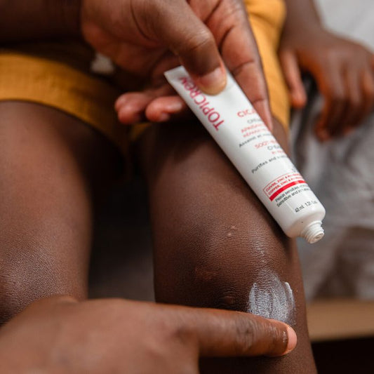 PADRES QUE APLICAN CREMA CICATRIZANTE EN LA RODILLA DE UN NIÑO
