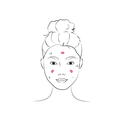 Routine étape 1 1. PREPARAR