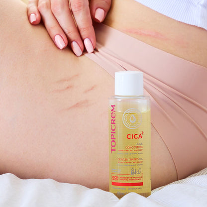 Aceite Cicatrices y Estrías - CICA+